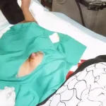 Tindakan Kesehatan Sunat Pada Seseorang