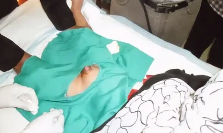 Tindakan Kesehatan Sunat Pada Seseorang
